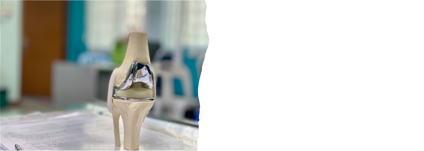 Αρθροπλαστική Γόνατος